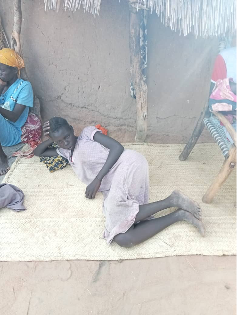 Returnee child dies due to diarrhea in Aweil East County